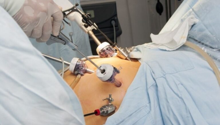 The Impact of Bariatric Surgery on Long-term Health and Wellness Impact of Bariatric Surgery